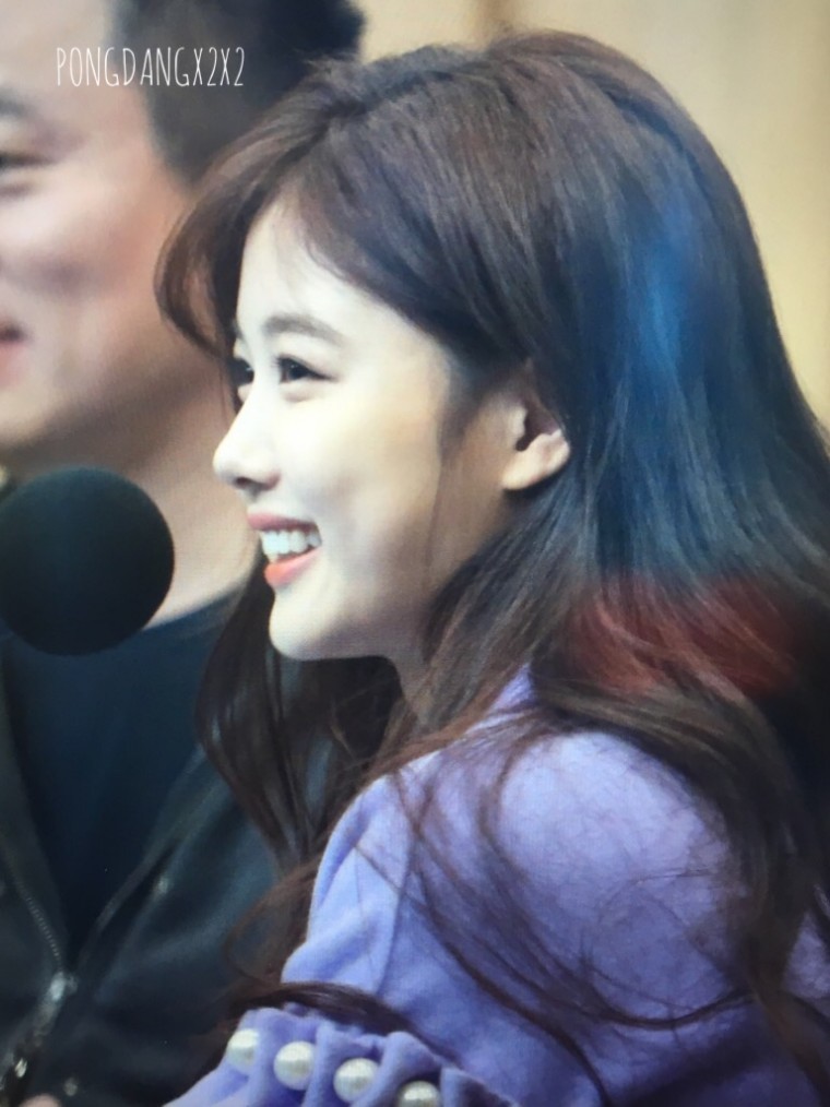 간만에 다시보는 김유정 사랑니뽑고 얼굴 부었던 사진. jpg | 인스티즈