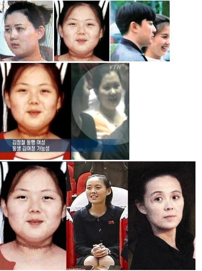 북한 김여정 심각하게 마른 이유 생각해보는 글 | 인스티즈