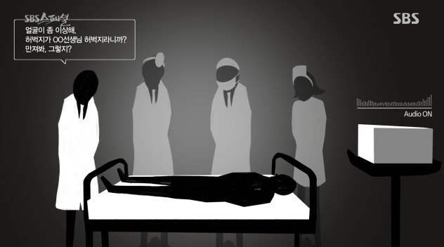 성형 수술한 남자가 녹음한 의사들 잡담 | 인스티즈