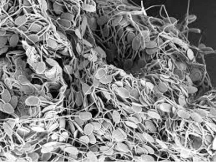 질내사정 전후 난자의 모습 | 인스티즈