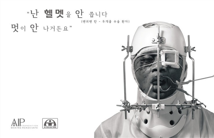 혐주의) 바이크 탈 때 헬멧이 필수인 이유 | 인스티즈