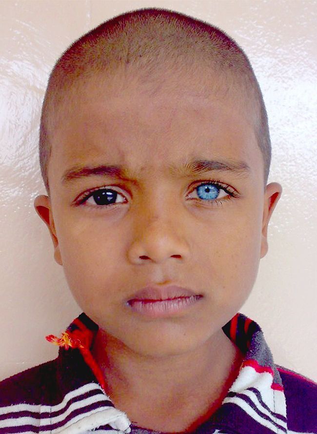 사람들이 하는 오해: 아시아 사람들은 다 눈동자가 짙은갈색? | 인스티즈