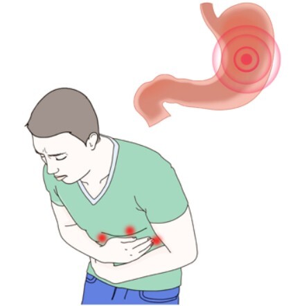 한번 겪으면 죽도록 아플수도있다는 흔한 질환.....jpg | 인스티즈