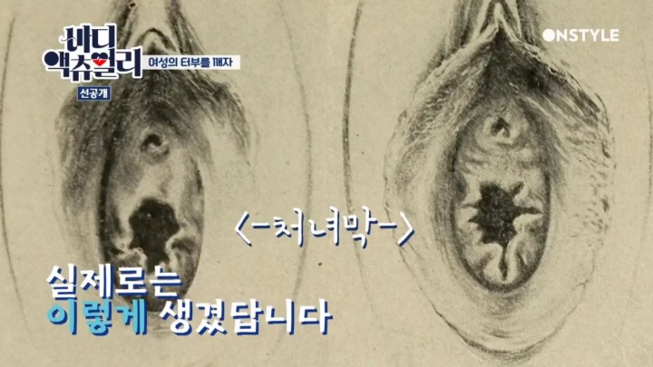실제 처녀막 사진.jpg | 인스티즈