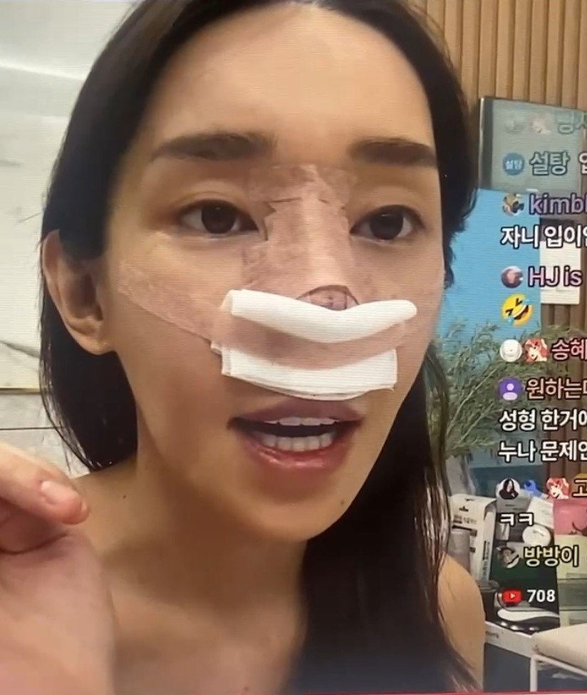 최근 15번째 코 수술을 마친 트랜스젠더 꽃자 | 인스티즈