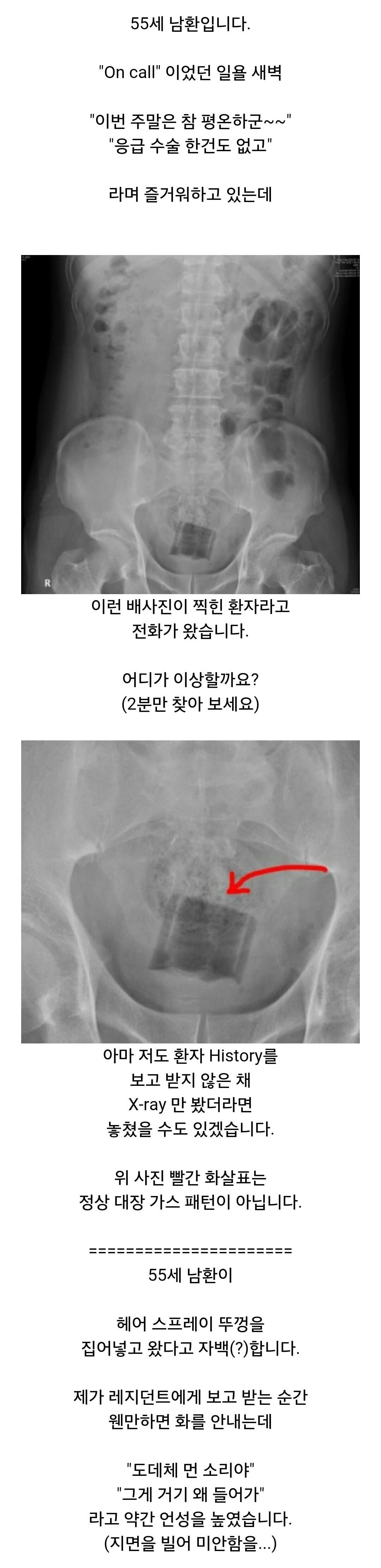 항문에 자꾸 뭘 넣는 남환자들때문에 고통받는 응급실의사분들ㅋㅋㅋㅋ | 인스티즈