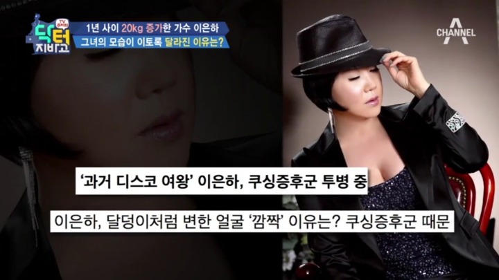스테로이드 부작용 중 하나.jpg | 인스티즈