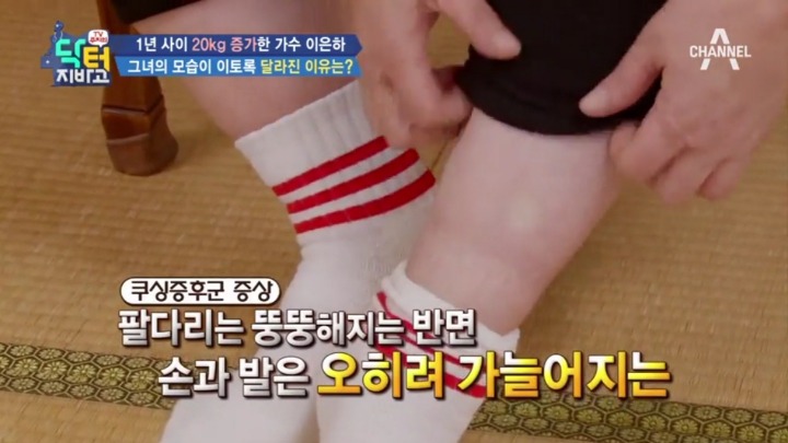 스테로이드 부작용 중 하나.jpg | 인스티즈
