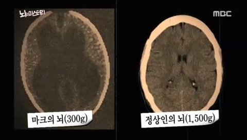 뇌의 미스테리 | 인스티즈