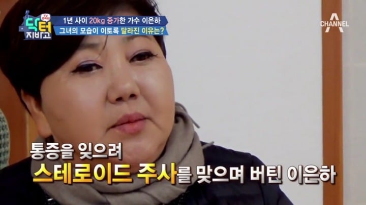 스테로이드 부작용 중 하나.jpg | 인스티즈