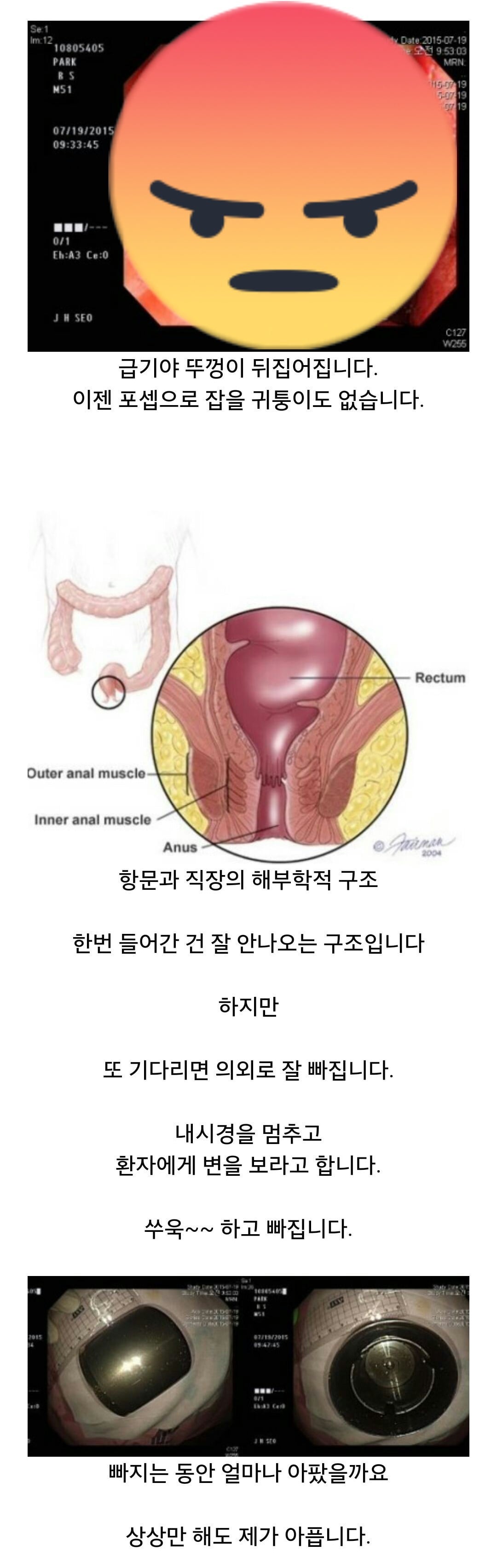 항문에 자꾸 뭘 넣는 남환자들때문에 고통받는 응급실의사분들ㅋㅋㅋㅋ | 인스티즈