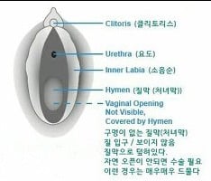 질막(처녀막)에 대해 넌 어디까지 알고있니? | 인스티즈