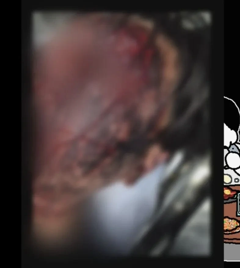 혐주의) 수탉 사건구조당시 사진 | 인스티즈