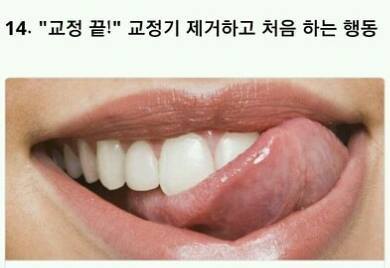 해본 사람만 아는 치아교정의 고통 | 인스티즈