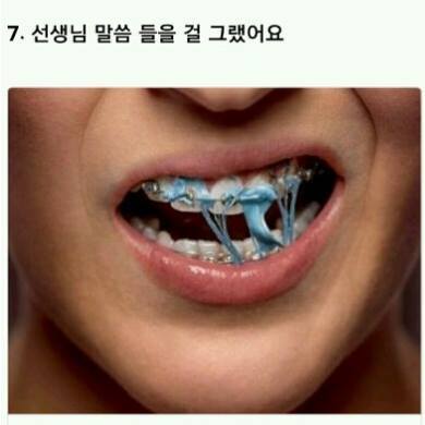 해본 사람만 아는 치아교정의 고통 | 인스티즈