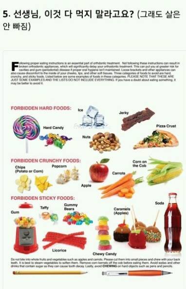 해본 사람만 아는 치아교정의 고통 | 인스티즈
