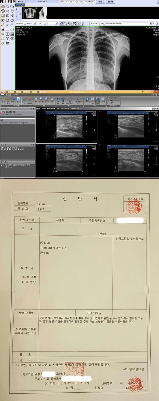 가슴성형루머때문에 인증까지 하게 된 여자연예인들 | 인스티즈