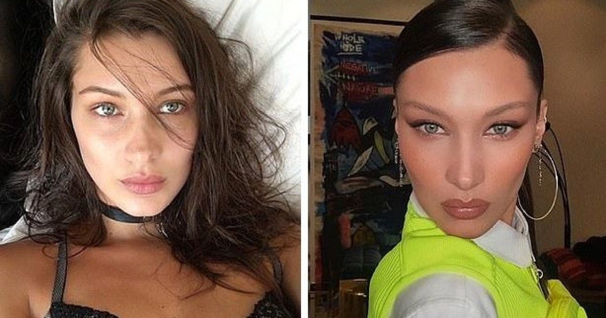 "하디드 눈 갖고 싶어"..'여우 눈' 시술 받은 후 숨진 유명 인플루언서 | 인스티즈