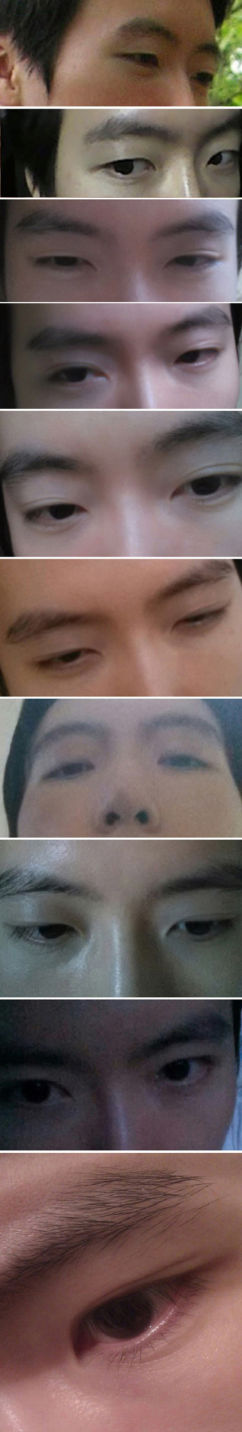 은근히 많이 생긴다는 '후천적 쌍꺼풀' | 인스티즈