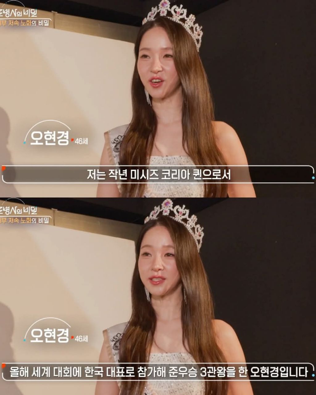 생로병사의 비밀에 나온 동안과 노안 | 인스티즈