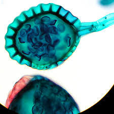우리가 흔히 먹는 고사리 나물..... (환공포증주의) +추가 | 인스티즈