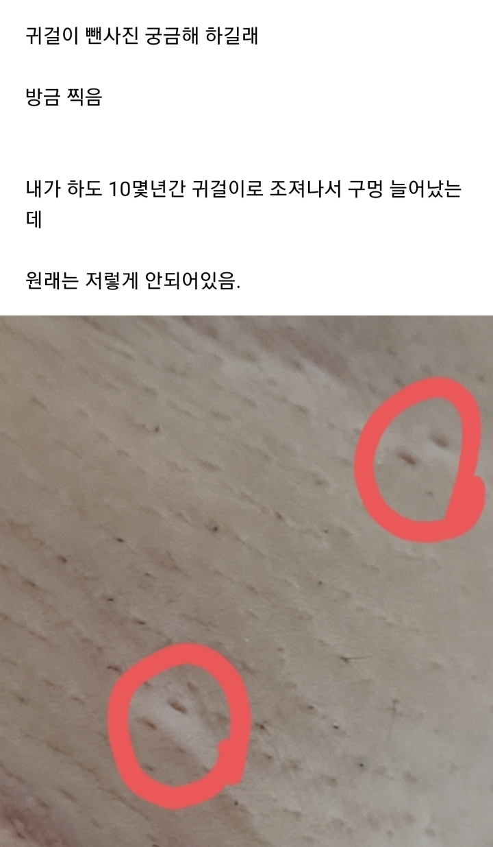 겨드랑이 터널의 정체를 알고 싶어하는 겨시 달글 캡쳐(겨드랑이 피어싱 사진있음 주의) | 인스티즈