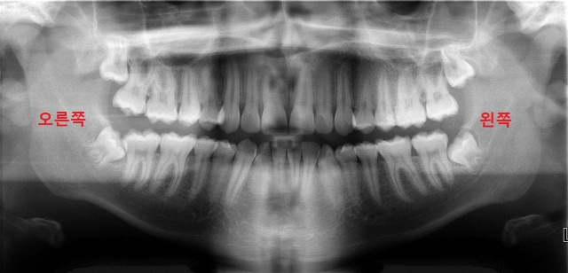 알아두면 좋은 치과 상식 | 인스티즈