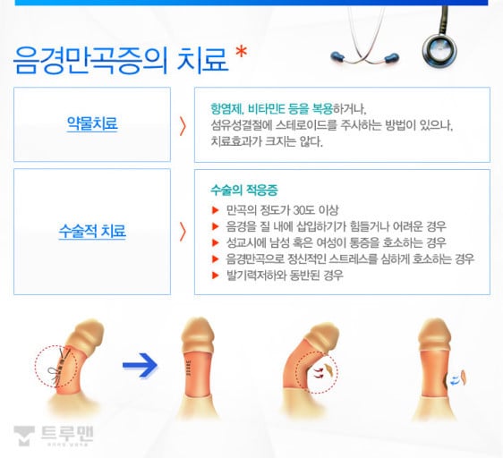 일부 남자들이 가지고 있는 음경만곡증 (페로니병) | 인스티즈