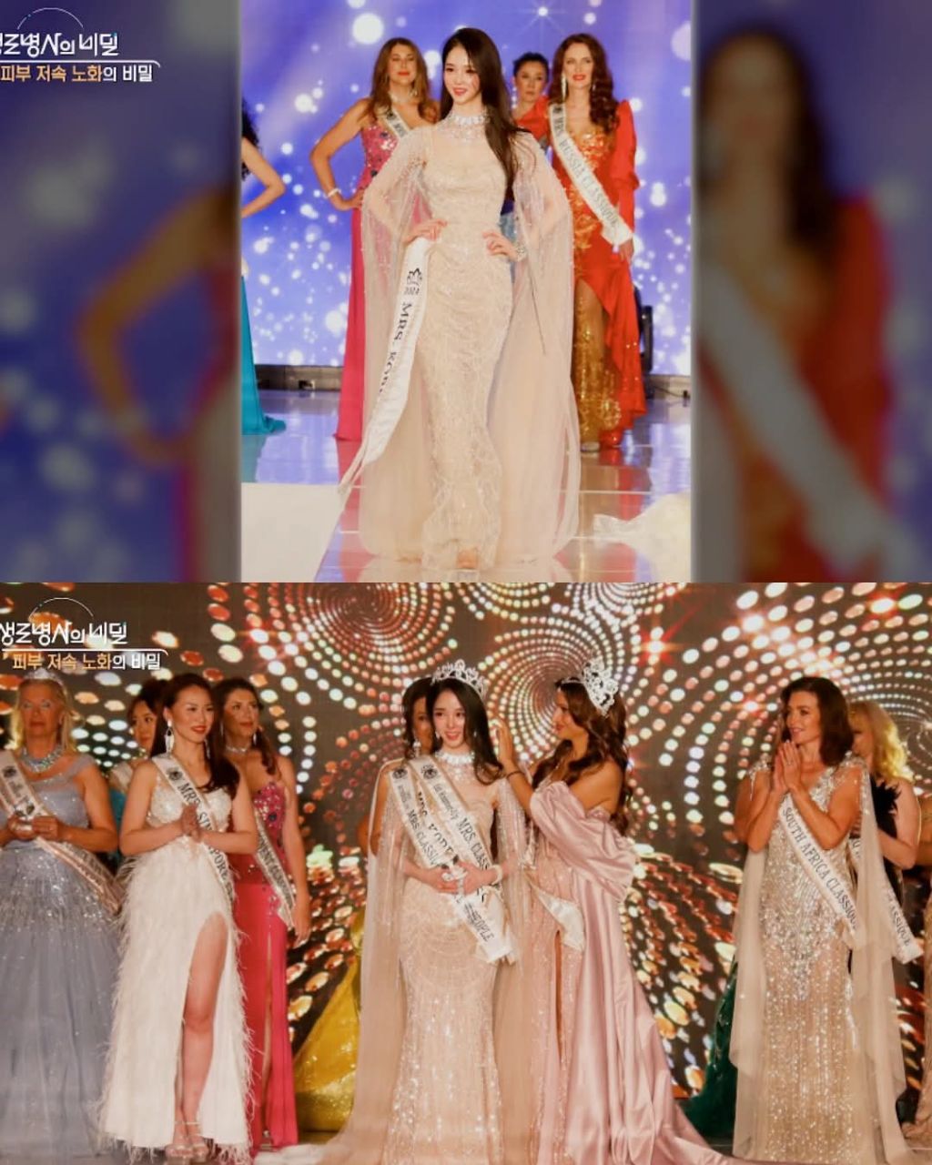 생로병사의 비밀에 나온 동안과 노안 | 인스티즈