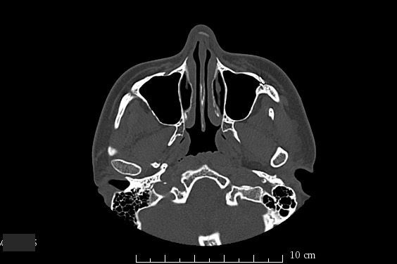 알아두면 좋은 치과 상식 | 인스티즈