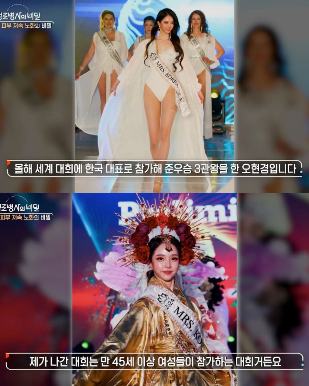 생로병사의 비밀에 나온 동안과 노안 | 인스티즈