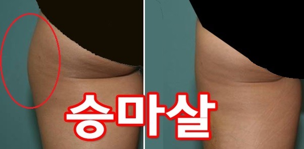 여자 골반에 대한 남자들의 착각 | 인스티즈