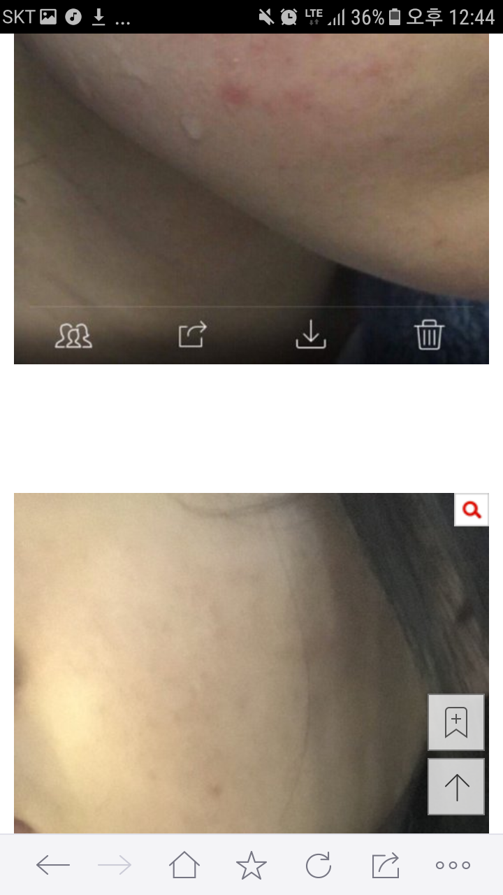 피부 안좋은사람들 진짜 90% 좋아지는법 알려줄게 | 인스티즈