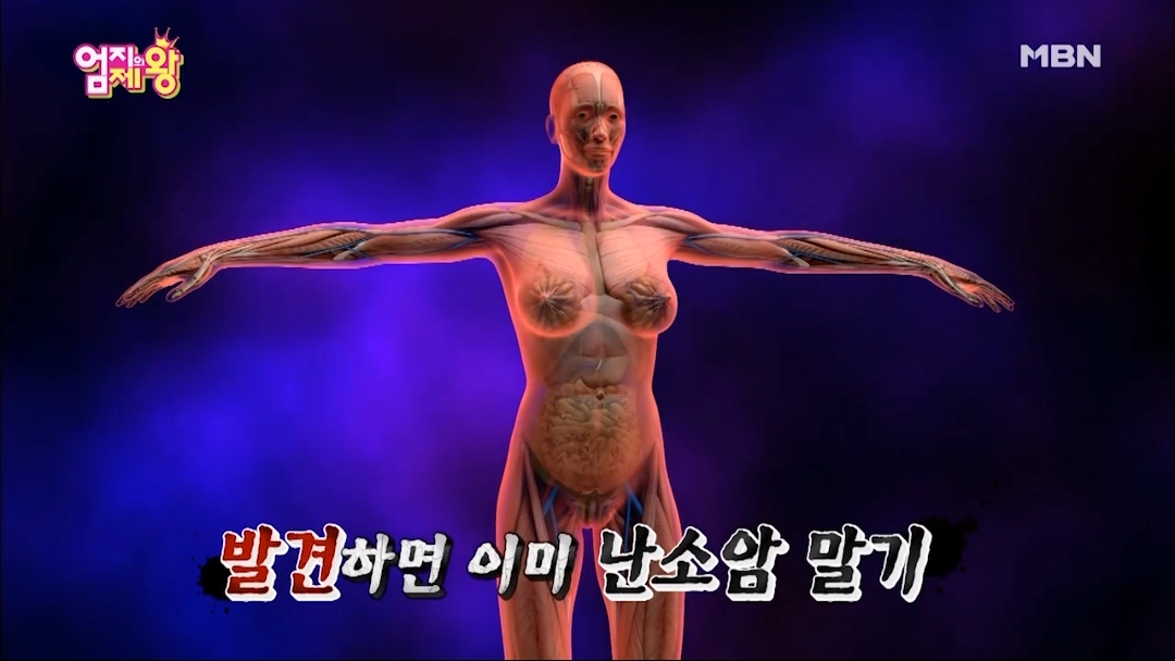 난소암이 무서운 이유.jpg | 인스티즈