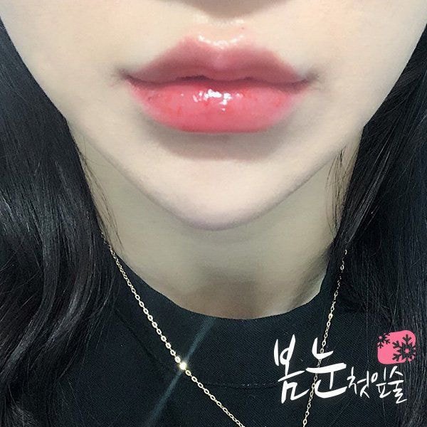 요즘 유행한다는 성형수술.jpg | 인스티즈