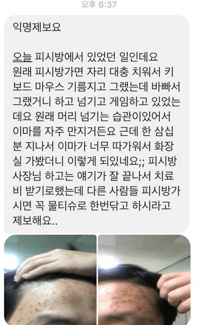 PC방 키보드를 주의해야 하는 이유 | 인스티즈