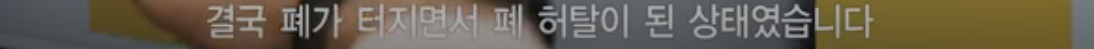 [충격] 전자담배는 충분히 해로움 | 인스티즈