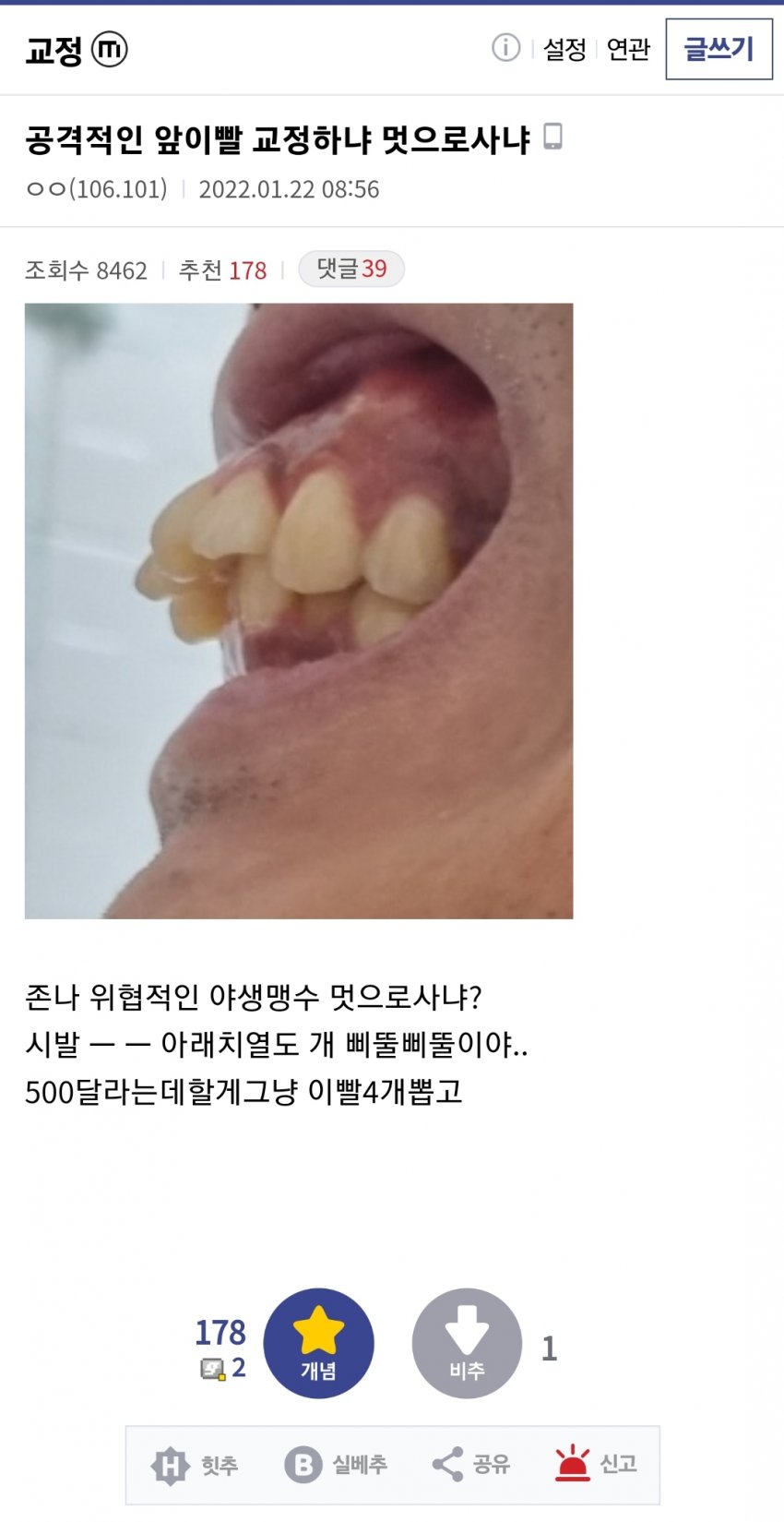 교정갤러리 레전드 | 인스티즈