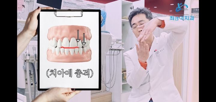 앞니로 라면도 잘라먹지 마세요 | 인스티즈