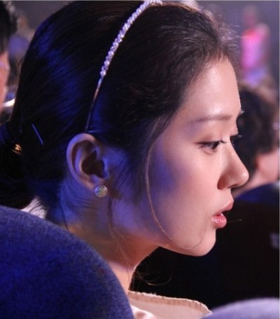콧대는 있는데 콧등이 없다는 연예인 | 인스티즈