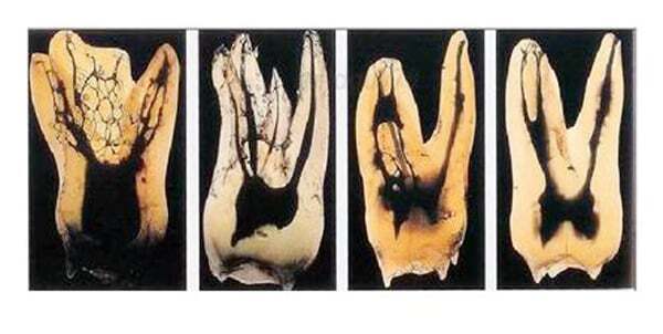 신경치료와 재신경치료...... | 인스티즈