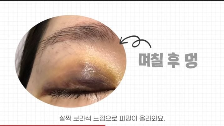 아이라인 문신을 말리는 이유 | 인스티즈