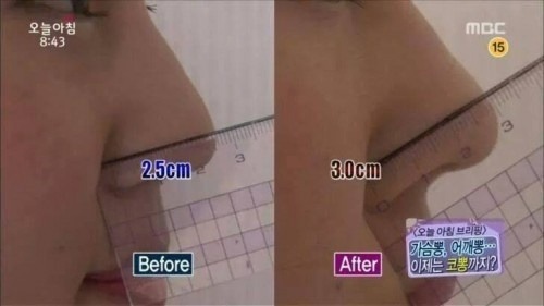 코를 높여준다는 코뽕!!!! 효과개쩜 주의 ㄷㄷㄷ | 인스티즈