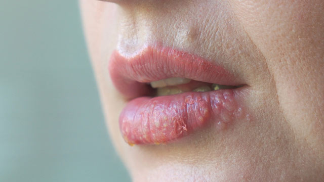 (혐) 걸리는 사람은 계속 걸리는 것.jpg | 인스티즈