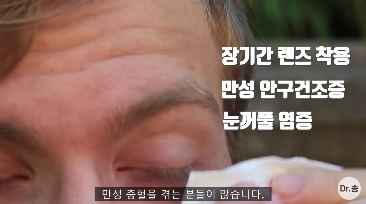눈 충혈 없애는 법 - 만성 충혈은 이렇게 관리하는 겁니다 | 인스티즈