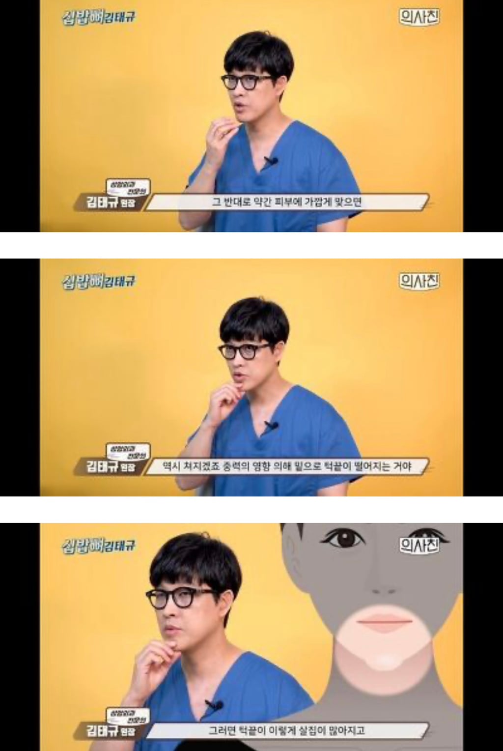 [필러 부작용] 의사피셜 필러 절대 맞지 말아야 할 4군데 | 인스티즈