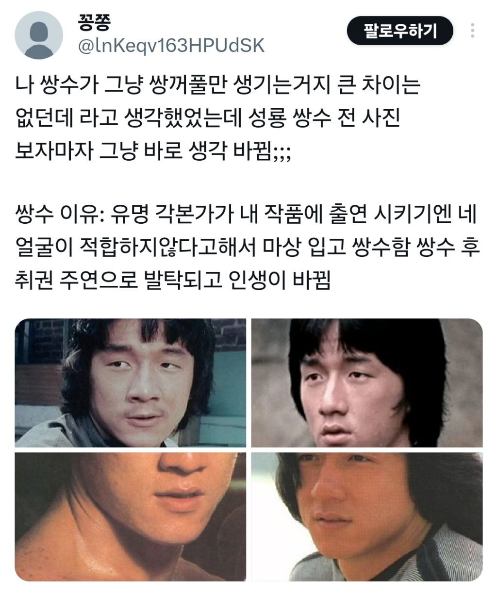쌍꺼풀 수술한다고 큰 변화 없던데;;;라고 생각했는데 | 인스티즈