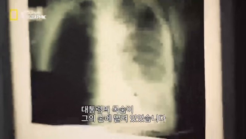 로널드 레이건 전 미국 대통령 저격 사건 | 인스티즈