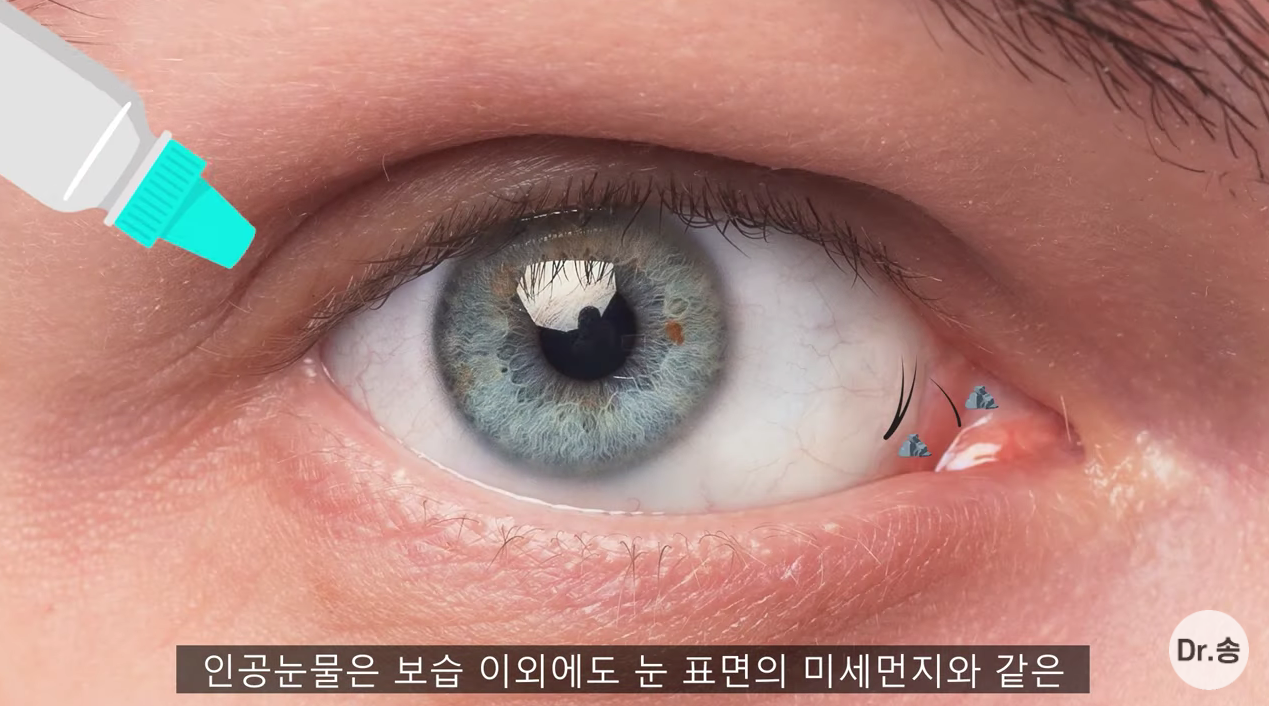눈 충혈 없애는 법 - 만성 충혈은 이렇게 관리하는 겁니다 | 인스티즈