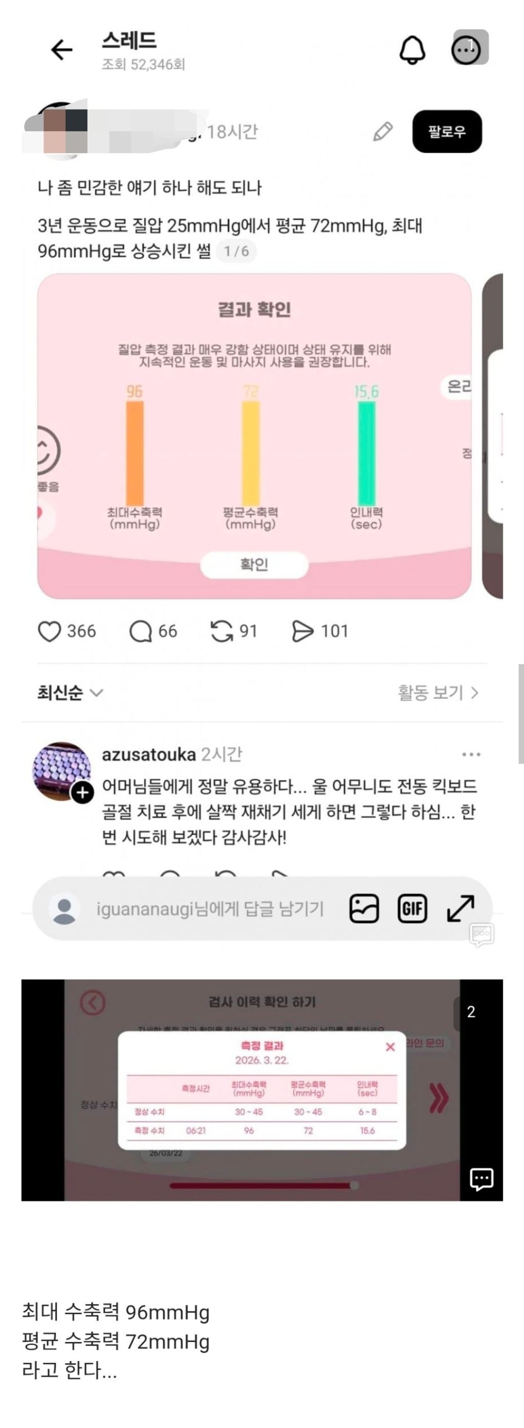 케겔운동 3년 한 결과...jpg | 인스티즈